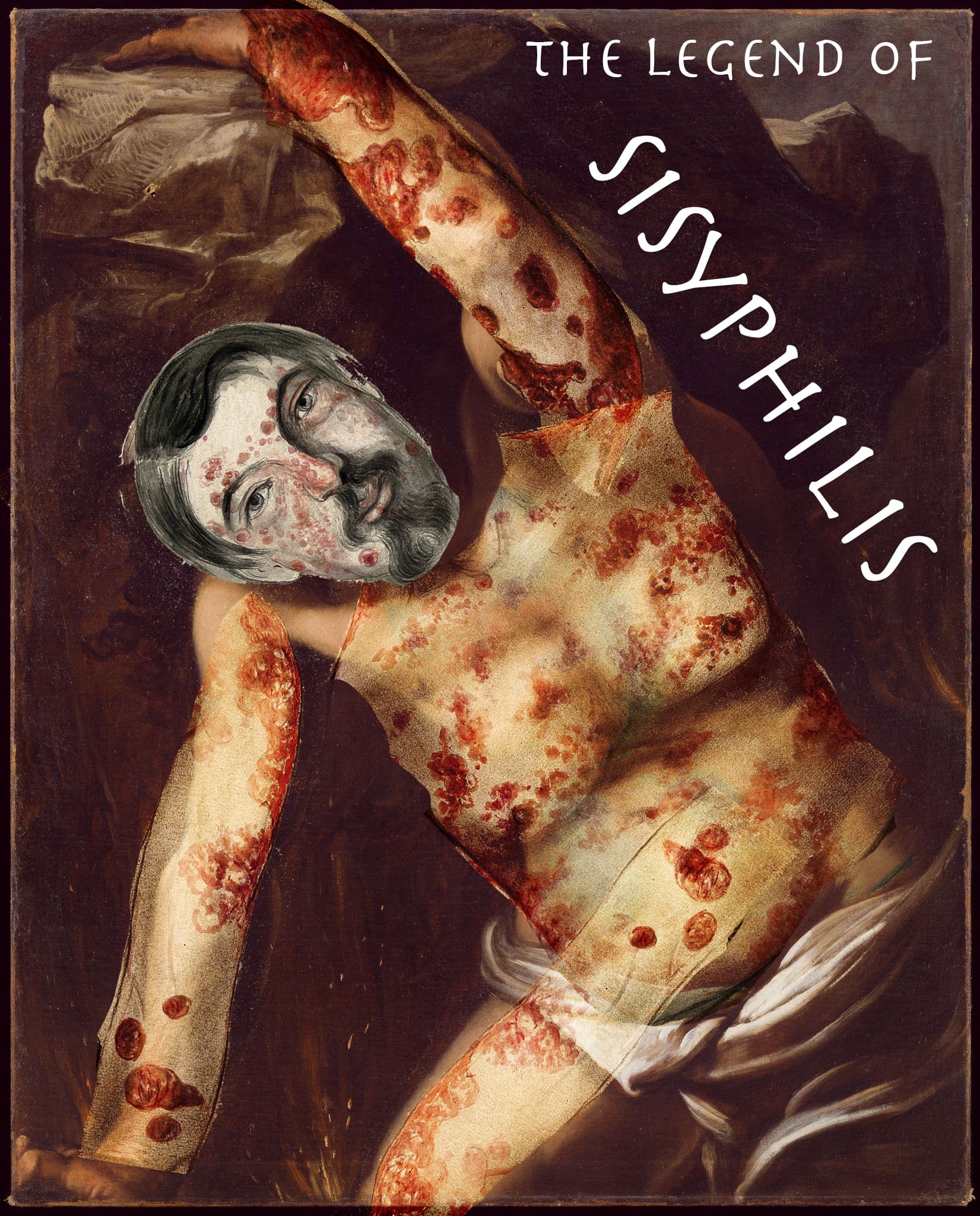Sisyphilis